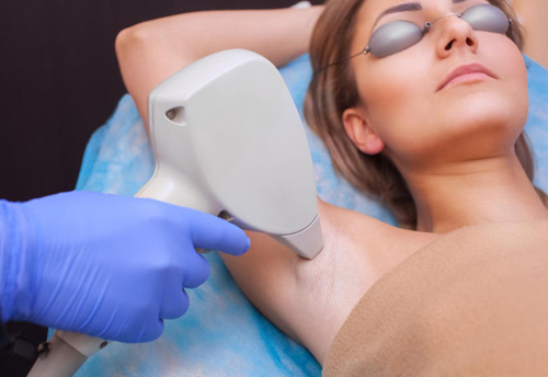 Safe and Effective Laser Hair Removal in Toronto